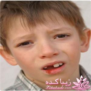 فوریتهای دندانپزشکی در کودکان چیست؟